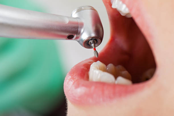 Best Pediatric Emergency Dentist in Shokan, NY